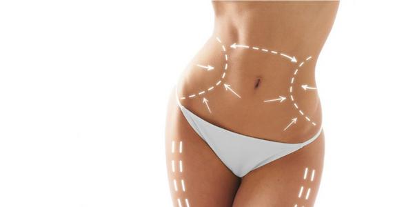Lipoescultura